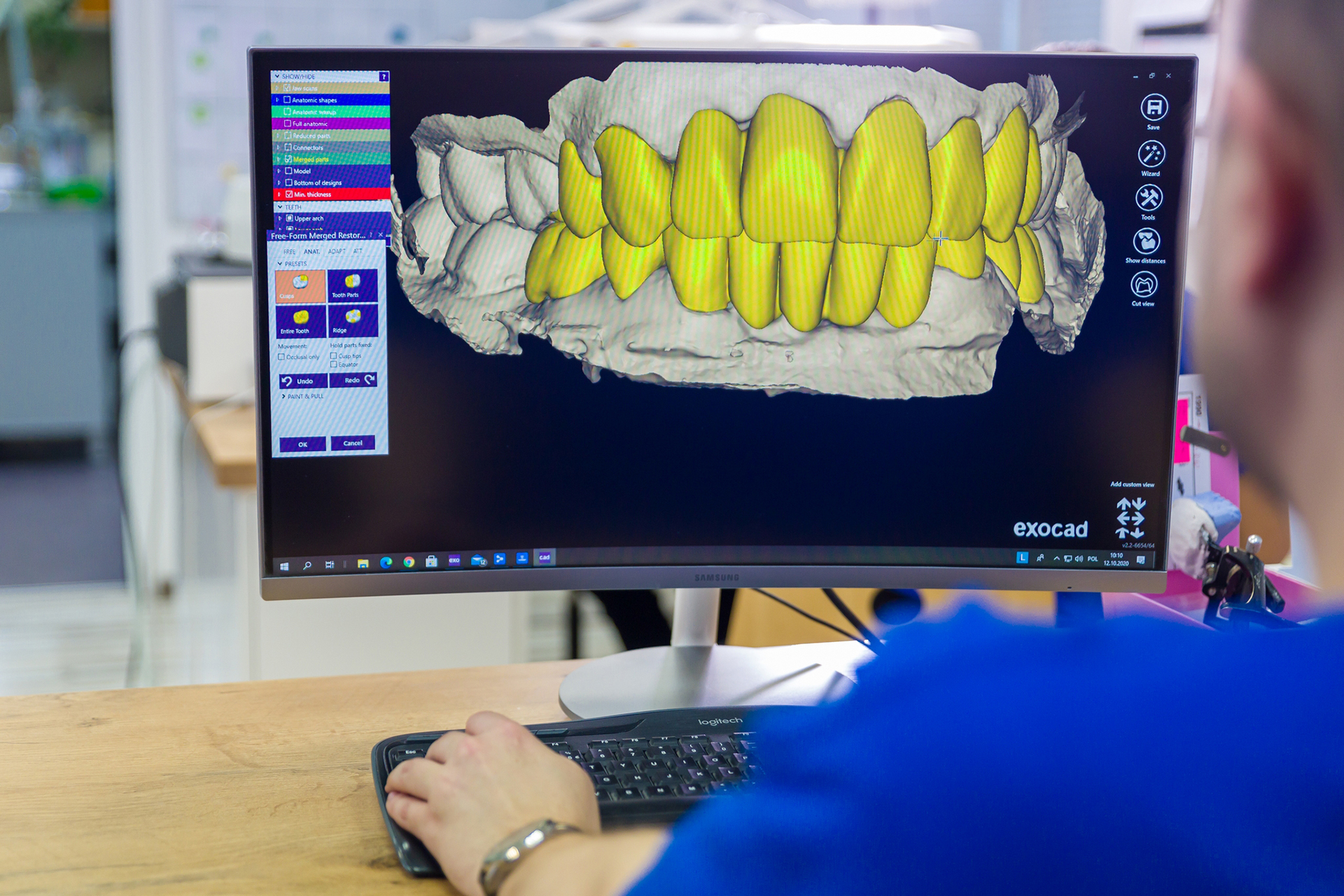 CAD/CAM